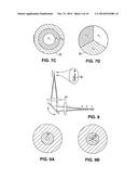 Method and Apparatus for Patterned Plasma-Mediated Laser Trephination of     the Lens Capsule and Three Dimensional Phaco- Segmentation diagram and image