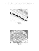 Method and Apparatus for Patterned Plasma-Mediated Laser Trephination of     the Lens Capsule and Three Dimensional Phaco- Segmentation diagram and image