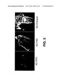 METHOD FOR ENHANCED PHOTOEPILATION BASED ON METALLIC NANO-COMPLEXES diagram and image