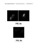 METHOD FOR ENHANCED PHOTOEPILATION BASED ON METALLIC NANO-COMPLEXES diagram and image