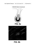 METHOD FOR ENHANCED PHOTOEPILATION BASED ON METALLIC NANO-COMPLEXES diagram and image