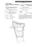 SYSTEMS AND METHODS FOR MINIMALLY INVASIVE FRACTURE REDUCTION AND FIXATION diagram and image