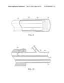 SYSTEMS AND METHODS FOR MINIMALLY INVASIVE FRACTURE REDUCTION AND FIXATION diagram and image