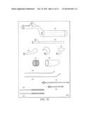 SYSTEMS AND METHODS FOR MINIMALLY INVASIVE FRACTURE REDUCTION AND FIXATION diagram and image