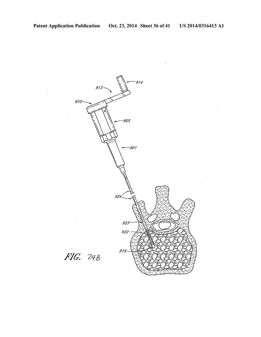 STEERABLE CURVABLE VERTEBROPLASTY DRILL - diagram, schematic, and image 37