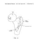 METHOD AND APPARATUS FOR RECONSTRUCTING A HIP JOINT, INCLUDING THE     PROVISION AND USE OF A NOVEL ARTHROSCOPIC DEBRIDEMENT TEMPLATE FOR     ASSISTING IN THE TREATMENT OF CAM-TYPE FEMOROACETABULAR IMPINGEMENT diagram and image