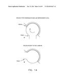 METHOD AND APPARATUS FOR RECONSTRUCTING A HIP JOINT, INCLUDING THE     PROVISION AND USE OF A NOVEL ARTHROSCOPIC DEBRIDEMENT TEMPLATE FOR     ASSISTING IN THE TREATMENT OF CAM-TYPE FEMOROACETABULAR IMPINGEMENT diagram and image