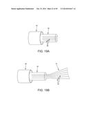 METHOD AND APPARATUS FOR RECONSTRUCTING A HIP JOINT, INCLUDING THE     PROVISION AND USE OF A NOVEL ARTHROSCOPIC DEBRIDEMENT TEMPLATE FOR     ASSISTING IN THE TREATMENT OF CAM-TYPE FEMOROACETABULAR IMPINGEMENT diagram and image