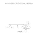 METHOD AND APPARATUS FOR RECONSTRUCTING A HIP JOINT, INCLUDING THE     PROVISION AND USE OF A NOVEL ARTHROSCOPIC DEBRIDEMENT TEMPLATE FOR     ASSISTING IN THE TREATMENT OF CAM-TYPE FEMOROACETABULAR IMPINGEMENT diagram and image