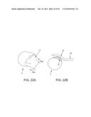 METHOD AND APPARATUS FOR RECONSTRUCTING A HIP JOINT, INCLUDING THE     PROVISION AND USE OF A NOVEL ARTHROSCOPIC DEBRIDEMENT TEMPLATE FOR     ASSISTING IN THE TREATMENT OF CAM-TYPE FEMOROACETABULAR IMPINGEMENT diagram and image