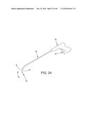 METHOD AND APPARATUS FOR RECONSTRUCTING A HIP JOINT, INCLUDING THE     PROVISION AND USE OF A NOVEL ARTHROSCOPIC DEBRIDEMENT TEMPLATE FOR     ASSISTING IN THE TREATMENT OF CAM-TYPE FEMOROACETABULAR IMPINGEMENT diagram and image