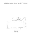 METHOD AND APPARATUS FOR RECONSTRUCTING A HIP JOINT, INCLUDING THE     PROVISION AND USE OF A NOVEL ARTHROSCOPIC DEBRIDEMENT TEMPLATE FOR     ASSISTING IN THE TREATMENT OF CAM-TYPE FEMOROACETABULAR IMPINGEMENT diagram and image