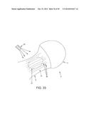 METHOD AND APPARATUS FOR RECONSTRUCTING A HIP JOINT, INCLUDING THE     PROVISION AND USE OF A NOVEL ARTHROSCOPIC DEBRIDEMENT TEMPLATE FOR     ASSISTING IN THE TREATMENT OF CAM-TYPE FEMOROACETABULAR IMPINGEMENT diagram and image