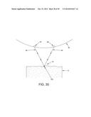 METHOD AND APPARATUS FOR RECONSTRUCTING A HIP JOINT, INCLUDING THE     PROVISION AND USE OF A NOVEL ARTHROSCOPIC DEBRIDEMENT TEMPLATE FOR     ASSISTING IN THE TREATMENT OF CAM-TYPE FEMOROACETABULAR IMPINGEMENT diagram and image