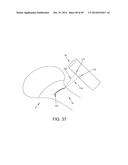 METHOD AND APPARATUS FOR RECONSTRUCTING A HIP JOINT, INCLUDING THE     PROVISION AND USE OF A NOVEL ARTHROSCOPIC DEBRIDEMENT TEMPLATE FOR     ASSISTING IN THE TREATMENT OF CAM-TYPE FEMOROACETABULAR IMPINGEMENT diagram and image