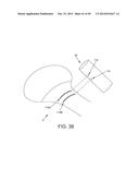 METHOD AND APPARATUS FOR RECONSTRUCTING A HIP JOINT, INCLUDING THE     PROVISION AND USE OF A NOVEL ARTHROSCOPIC DEBRIDEMENT TEMPLATE FOR     ASSISTING IN THE TREATMENT OF CAM-TYPE FEMOROACETABULAR IMPINGEMENT diagram and image