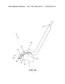 METHOD AND APPARATUS FOR RECONSTRUCTING A HIP JOINT, INCLUDING THE     PROVISION AND USE OF A NOVEL ARTHROSCOPIC DEBRIDEMENT TEMPLATE FOR     ASSISTING IN THE TREATMENT OF CAM-TYPE FEMOROACETABULAR IMPINGEMENT diagram and image