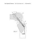 DEVICE AND METHOD FOR USE DURING LIGAMENT RECONSTRUCTION diagram and image