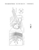 SYSTEMS AND METHODS FOR ROBOT-ASSISTED TRANSURETHRAL EXPLORATION AND     INTERVENTION diagram and image