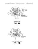 APPARATUS FOR THE TREATMENT OF TISSUE diagram and image