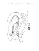 APPARATUS FOR THE TREATMENT OF TISSUE diagram and image