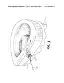 APPARATUS FOR THE TREATMENT OF TISSUE diagram and image