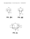 APPARATUS FOR THE TREATMENT OF TISSUE diagram and image