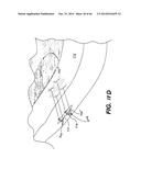 APPARATUS FOR THE TREATMENT OF TISSUE diagram and image