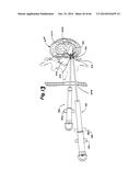 APPARATUS FOR THE TREATMENT OF TISSUE diagram and image