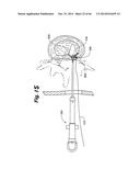 APPARATUS FOR THE TREATMENT OF TISSUE diagram and image