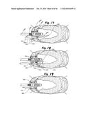 APPARATUS FOR THE TREATMENT OF TISSUE diagram and image