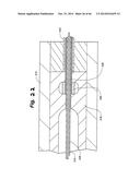 APPARATUS FOR THE TREATMENT OF TISSUE diagram and image