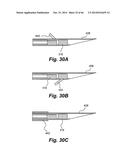 APPARATUS FOR THE TREATMENT OF TISSUE diagram and image