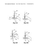 APPARATUS FOR THE TREATMENT OF TISSUE diagram and image