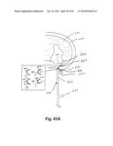 APPARATUS FOR THE TREATMENT OF TISSUE diagram and image