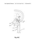 APPARATUS FOR THE TREATMENT OF TISSUE diagram and image