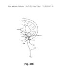 APPARATUS FOR THE TREATMENT OF TISSUE diagram and image