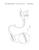 MULTIPLE CLIP ENDOSCOPIC TISSUE CLIPPING SYSTEM AND DEVICE diagram and image