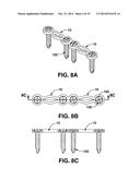 COMPRESSION BRACE diagram and image