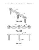 COMPRESSION BRACE diagram and image