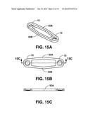 COMPRESSION BRACE diagram and image