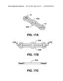 COMPRESSION BRACE diagram and image