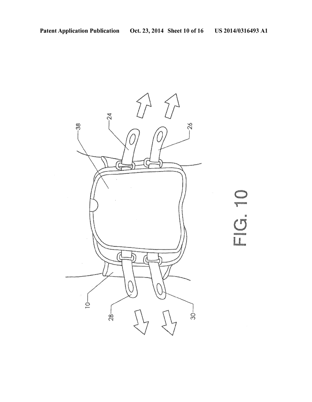 Lumbar Cryotherapy Belt with Access Window - diagram, schematic, and image 11