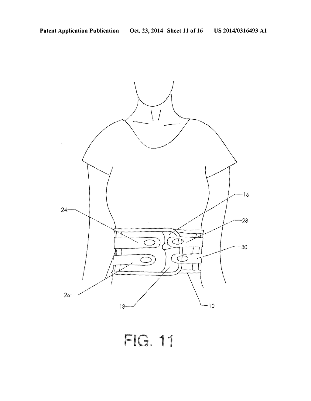 Lumbar Cryotherapy Belt with Access Window - diagram, schematic, and image 12