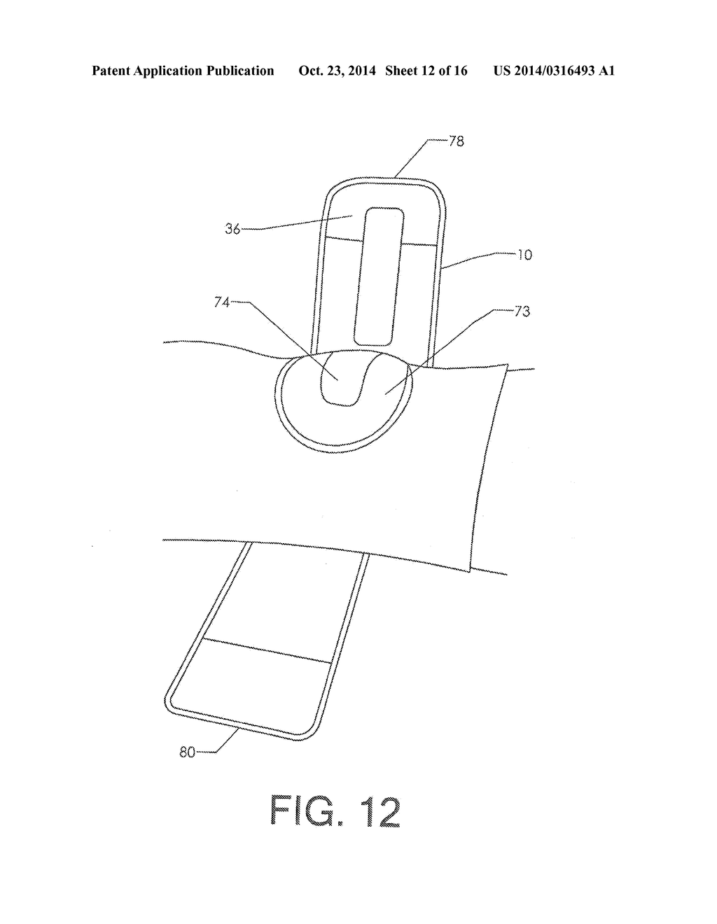 Lumbar Cryotherapy Belt with Access Window - diagram, schematic, and image 13