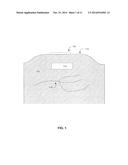 SUTURE HOLES ON A FLEXIBLE IMPLANT diagram and image