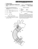 HEART VALVE AND ENDOVASCULAR GRAFT COMPONENTS AND METHOD FOR DELIVERY diagram and image