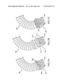 HEART VALVE AND ENDOVASCULAR GRAFT COMPONENTS AND METHOD FOR DELIVERY diagram and image