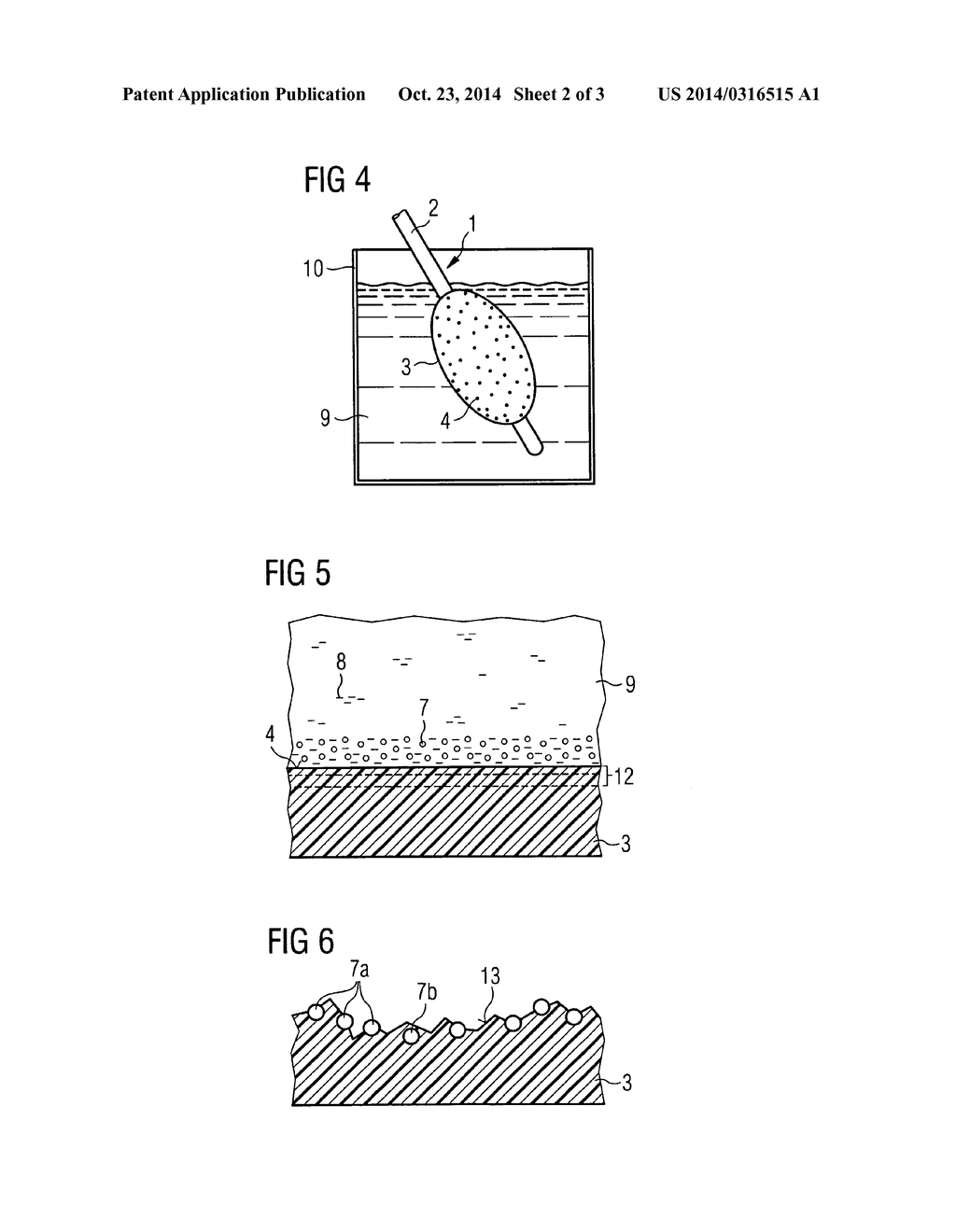 Method for producing a bioactive surface on an endoprosthesis or on the     balloon of a balloon catheter - diagram, schematic, and image 03