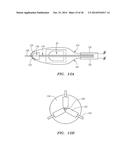 METHODS AND DEVICES FOR DELIVERY OF PROSTHETIC HEART VALVES AND OTHER     PROSTHETICS diagram and image